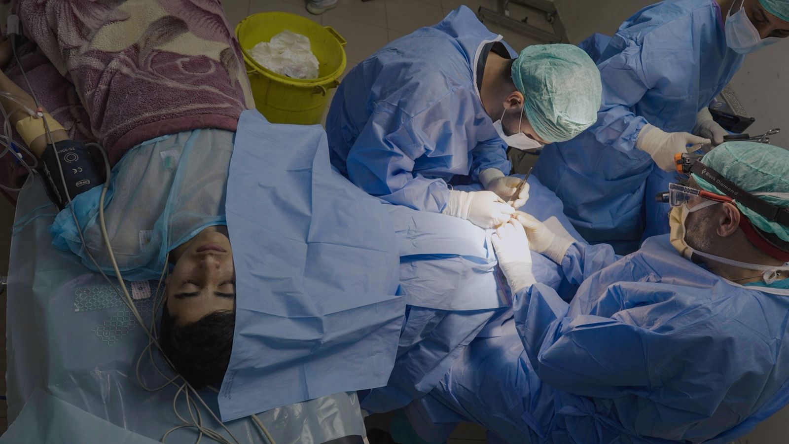 a GROUP OF DOCTORS PERFORMS A SURGERY