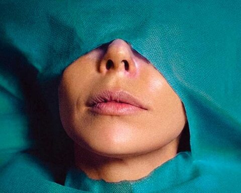 An Iranian woman is pictured in close up, lying beneath a teal surgical sheet. The sheet covers her body, with a hole cut that exposes her face from the nose to her chin.